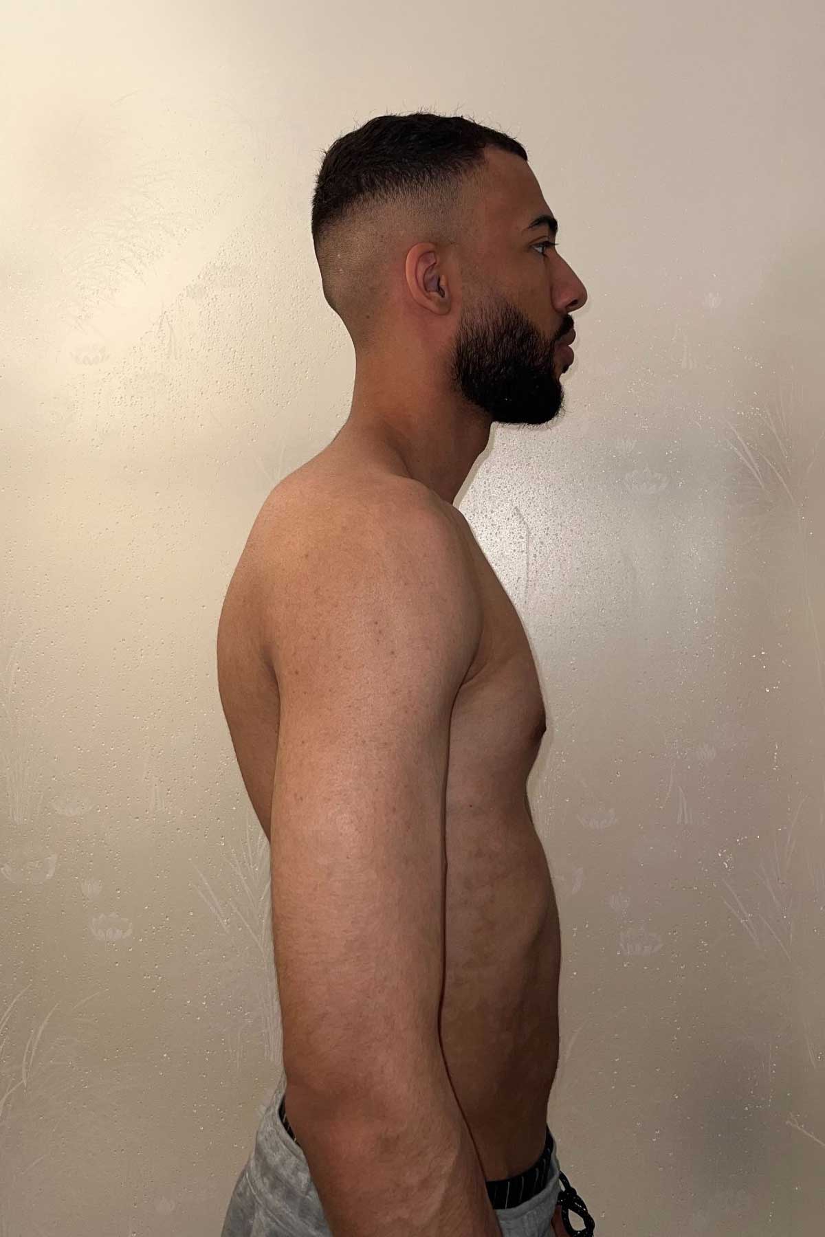 Before Transformation 2