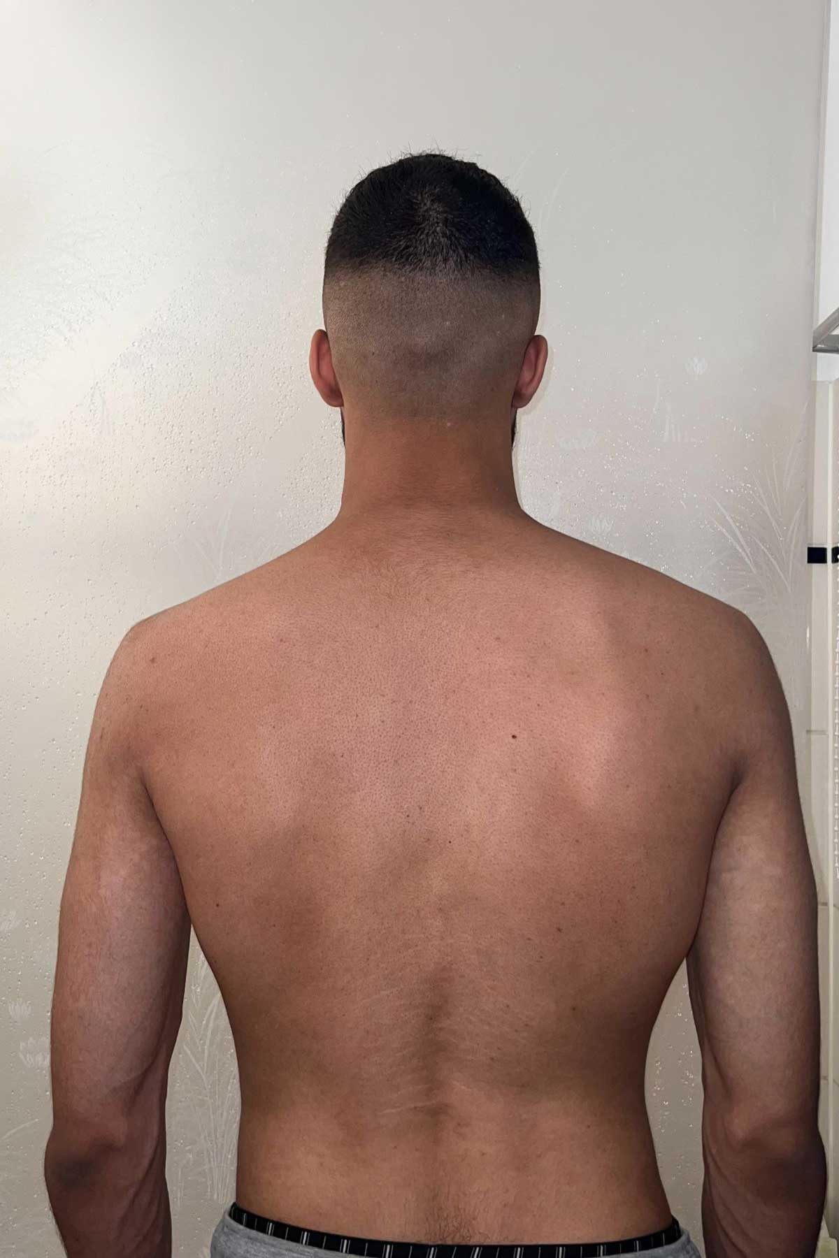 Before Transformation 3